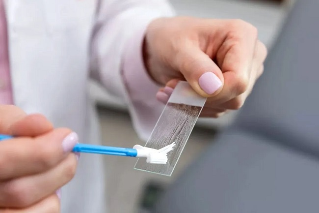 Campanie de testare gratuită pentru depistarea precoce a cancerului de col uterin, la Timişoara