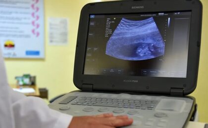 Focar de tuberculoză într-un mare oraș al Italiei în care trăiesc zeci de mii de români 1 Focar de tuberculoză într-un mare oraș al Italiei în care trăiesc zeci de mii de români
