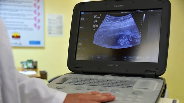 Focar de tuberculoză într-un mare oraș al Italiei în care trăiesc zeci de mii de români 1 Focar de tuberculoză într-un mare oraș al Italiei în care trăiesc zeci de mii de români