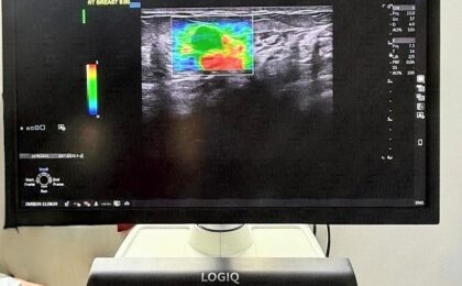 Ecograf de ultimă generaţie, la OncoHelp Timişoara