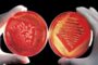 Medicii timișoreni atrag atenția asupra pericolului reprezentat de bacteria care se hrănește cu carne