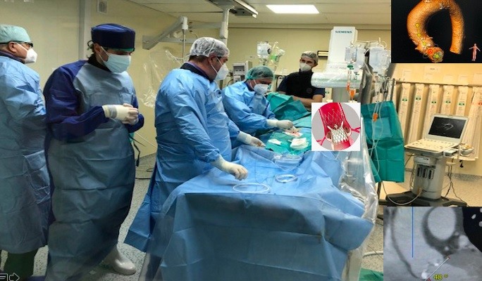 Două operaţii deosebite, realizate la Institutul de Boli Cardiovasculare Timişoara