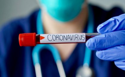 coronavirus 29