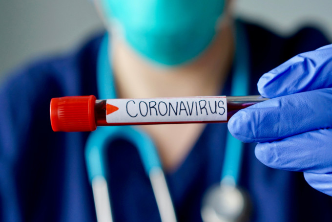 coronavirus 29