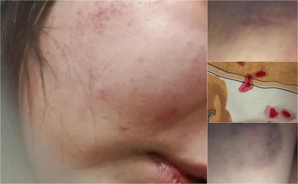 Vicepreședintele CJ Timiș, Alin Popoviciu, cere găsirea vinovaților și prevenție, după incidentul de la Centrul de Minori Găvojdia 2 fetita batuta gavojdia