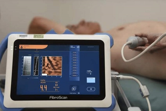 Fibroscan-ul, aparatul din cadrul Spitalului "Victor Babeș" Timișoara, care permite stabilirea sănătății ficatului