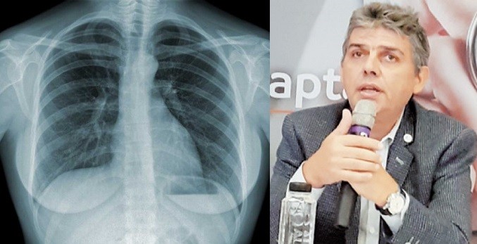 Medicii de la Spitalul "Dr. Victor Babeș" din Timişoara atrag atenția că a crescut prevalența astmului bronșic