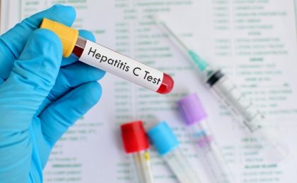 hepatita c test