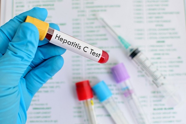 hepatita c test