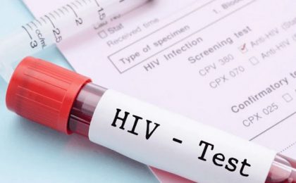 Fond pentru testarea HIV a întregii populații / Streinu-Cercel cere un program prin care în maxim 3 ani românii să fie testați pentru hepatită B, C şi HIV