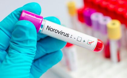 Inspectoratul Şcolar Judeţean Timiş a transmis o notificare către toate unităţile de învăţământ, prin care se cere luarea unor măsuri de prevenţie suplimentare în contextul unui focar de infecţie cu Norovirus în judeţ.