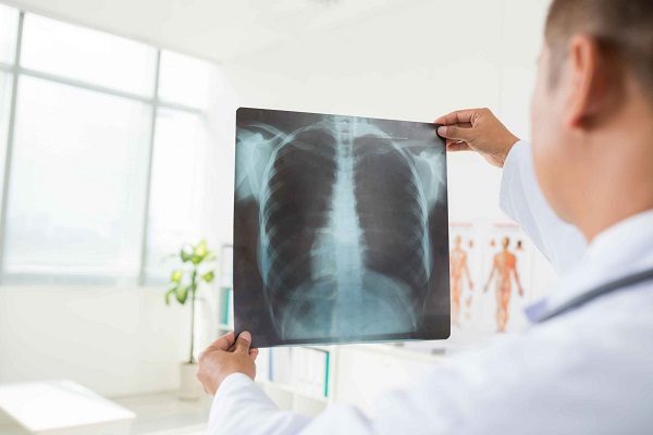 La Spitalul Județean Timișoara, radiografiile se interpretează cu ajutorul Inteligenței Artificiale