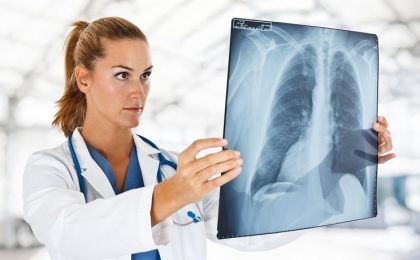 radiografie plamani