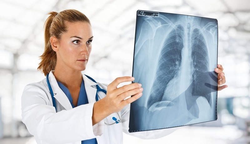 radiografie plamani