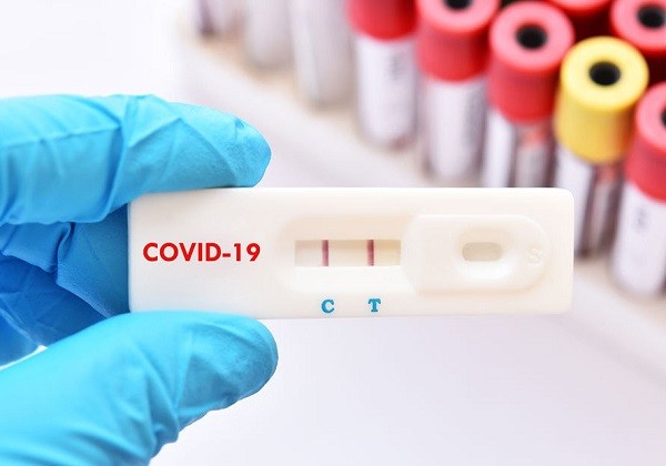 Test PCR sau antigen COVID negativ, obligatoriu pentru români la intrarea în Austria. De când se aplică noile reguli