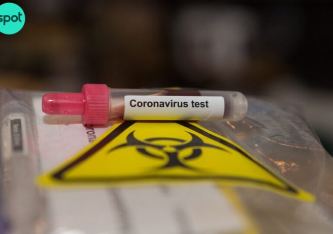 test coronavirus 2