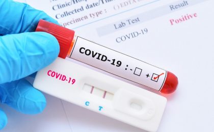 212 cazuri de îmbolnăvire de COVID-19 în Timiș. Localitățile în care au apărut infectări