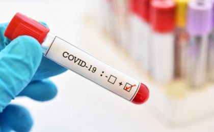 73 de îmbolnăviri de COVID-19 în județul Timiș