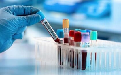 Un test de sânge poate detecta 12 tipuri de cancer înainte de apariția simptomelor