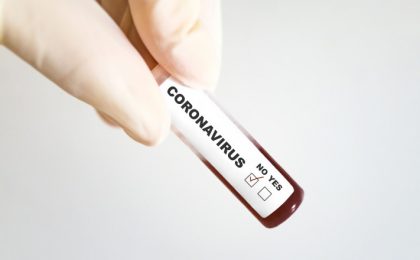 Bilanț provizoriu coronavirus. Scade numărul de infectări: 17.447 în 24 de ore
