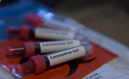 Alertă InfoCons: Peste 100 de teste rapide antigen COVID-19 au fost respinse