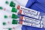 Două noi cazuri de variola maimuței, diagnosticate în România