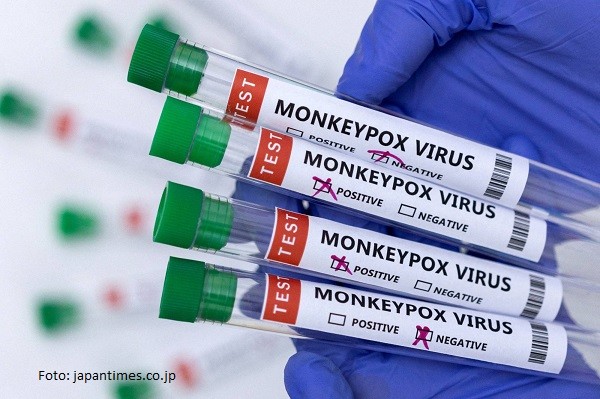 Al patrulea caz de variola maimuței, diagnosticat în România